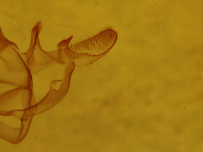 genitalia view of adult Xanthotype sospeta