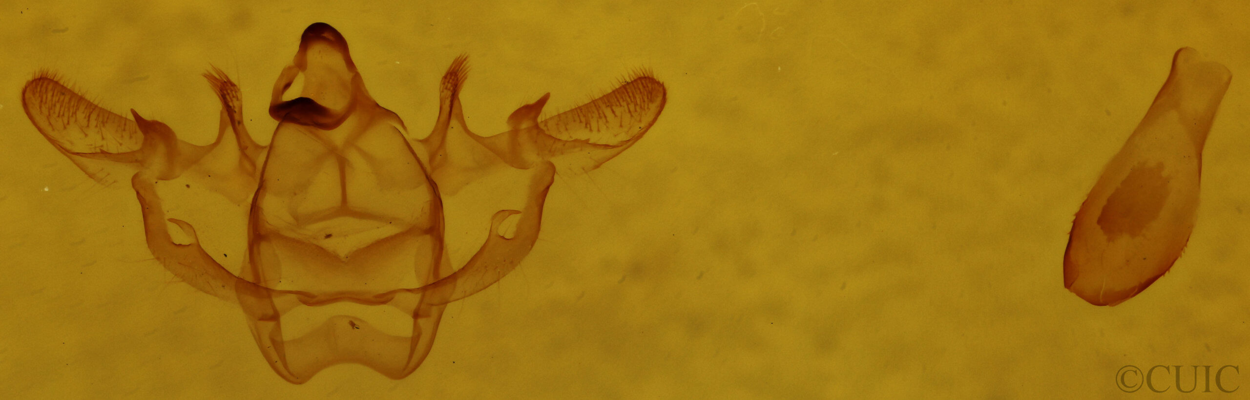 genitalia view of adult Xanthotype sospeta