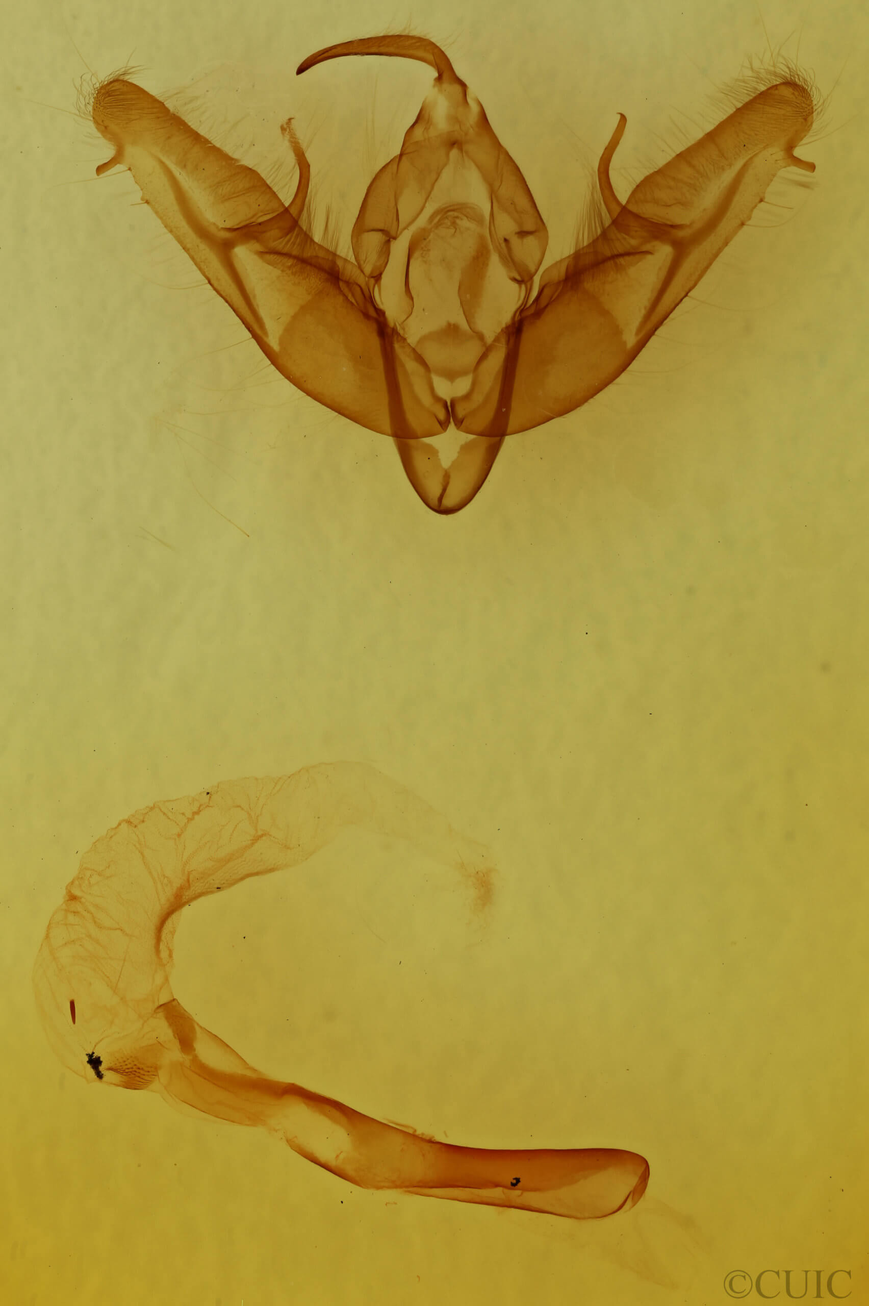 genitalia view of adult Xestia dilucida