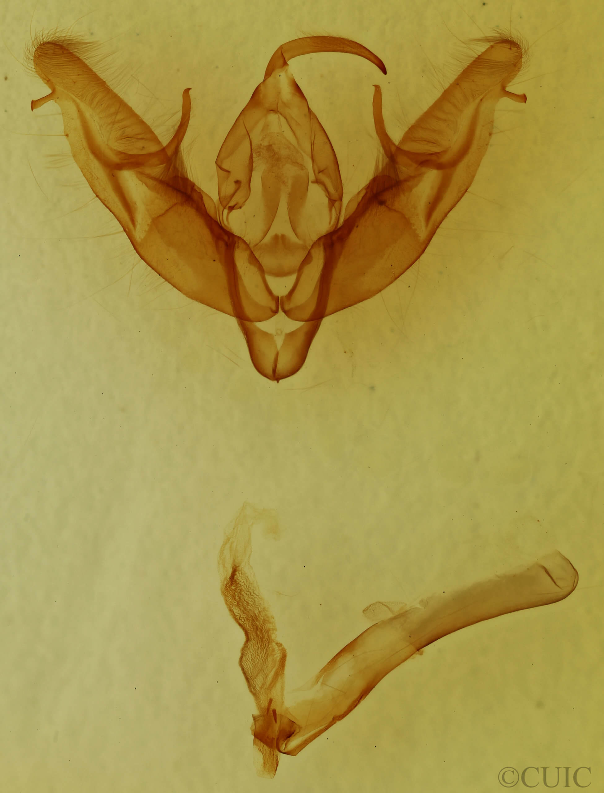 genitalia view of adult Xestia dilucida
