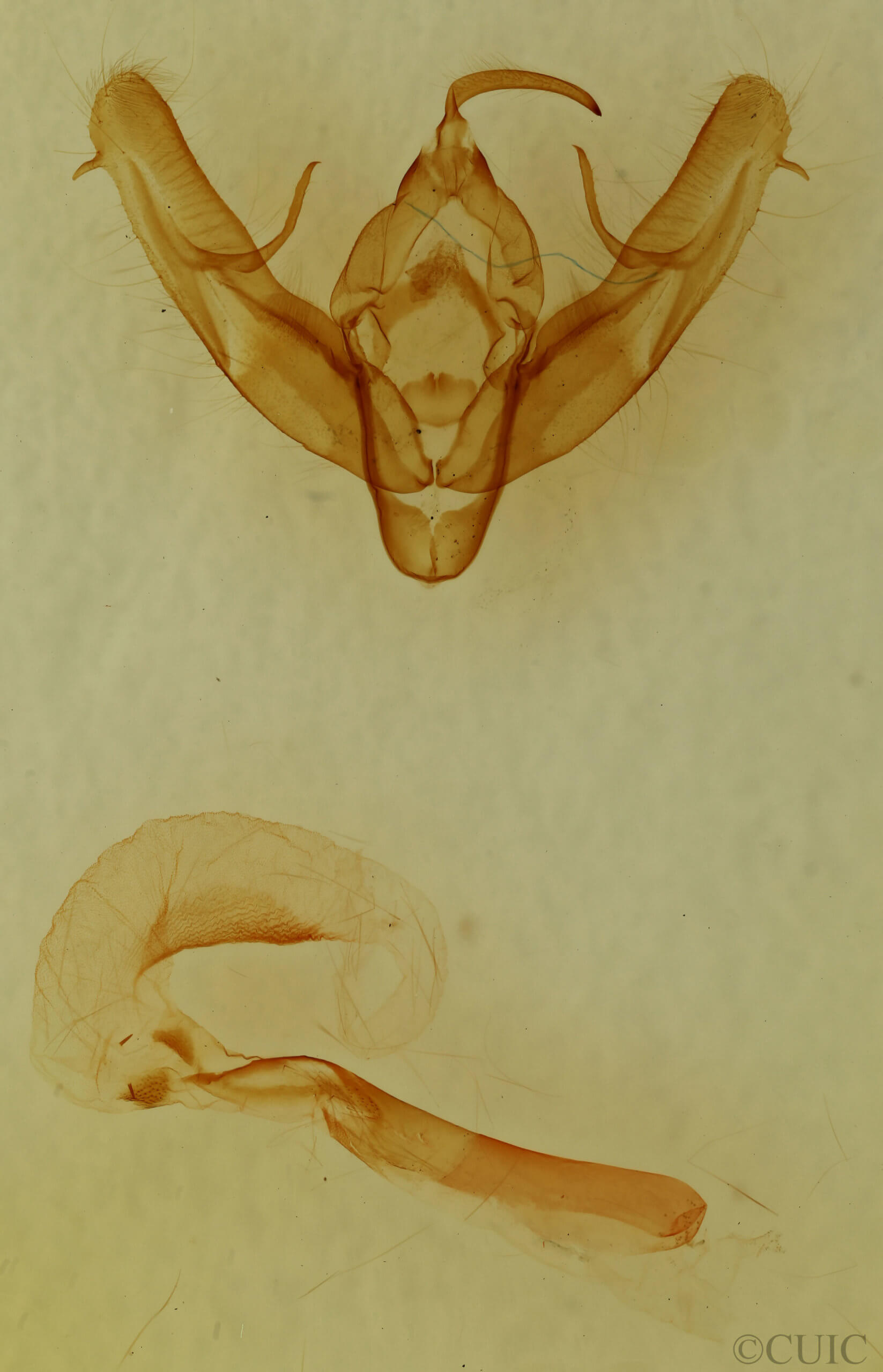 genitalia view of adult Xestia elimata