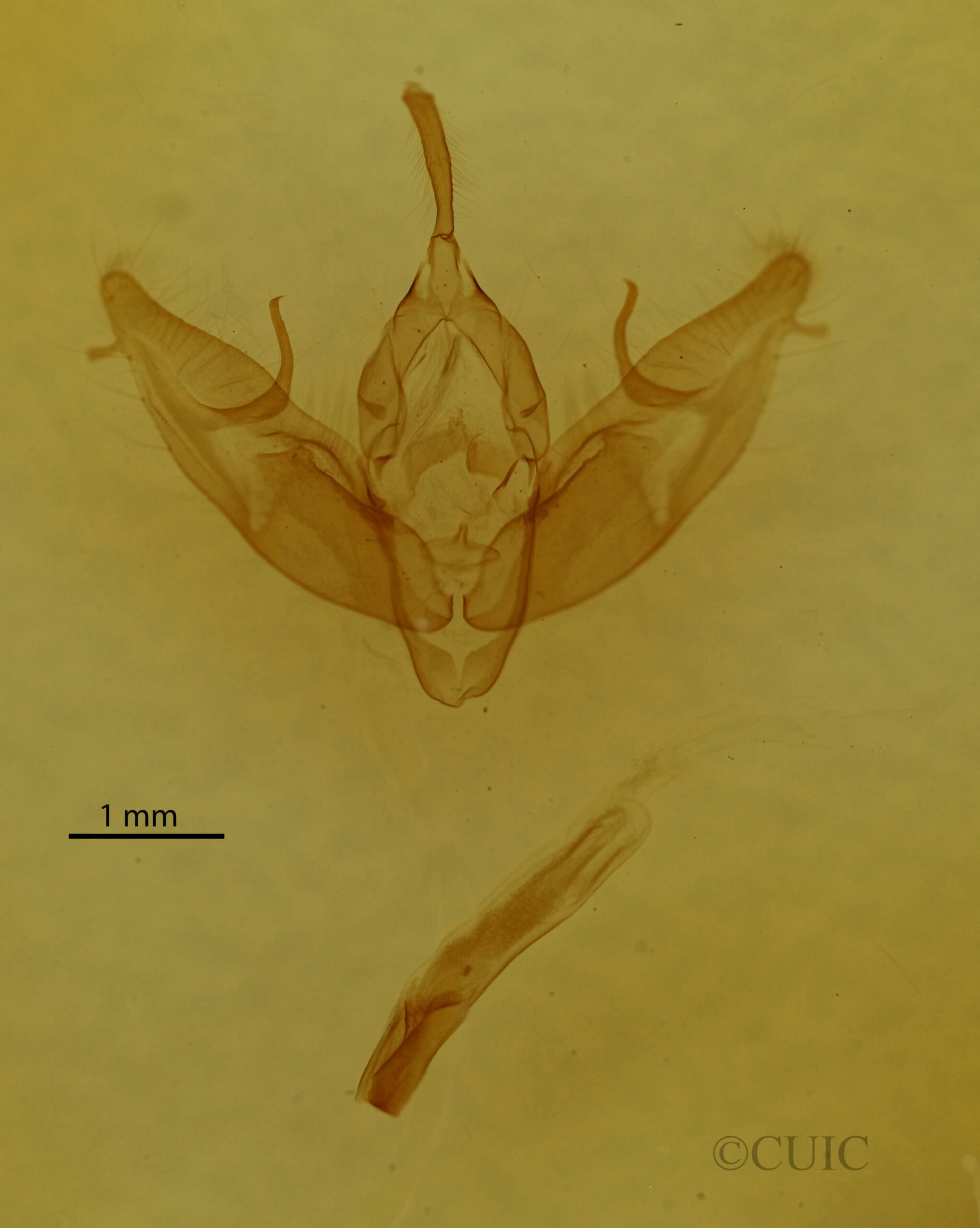 genitalia view of adult Xestia dilucida