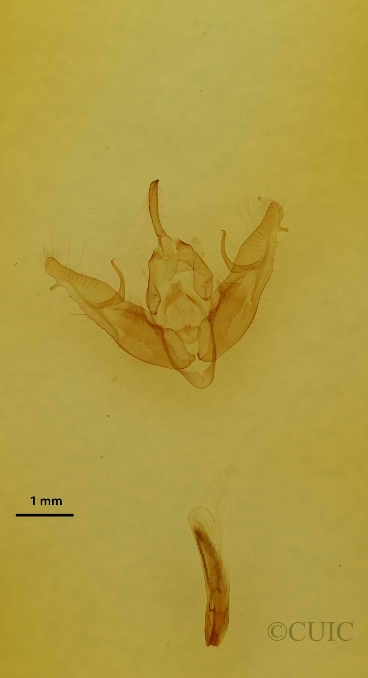 genitalia view of adult Xestia dilucida