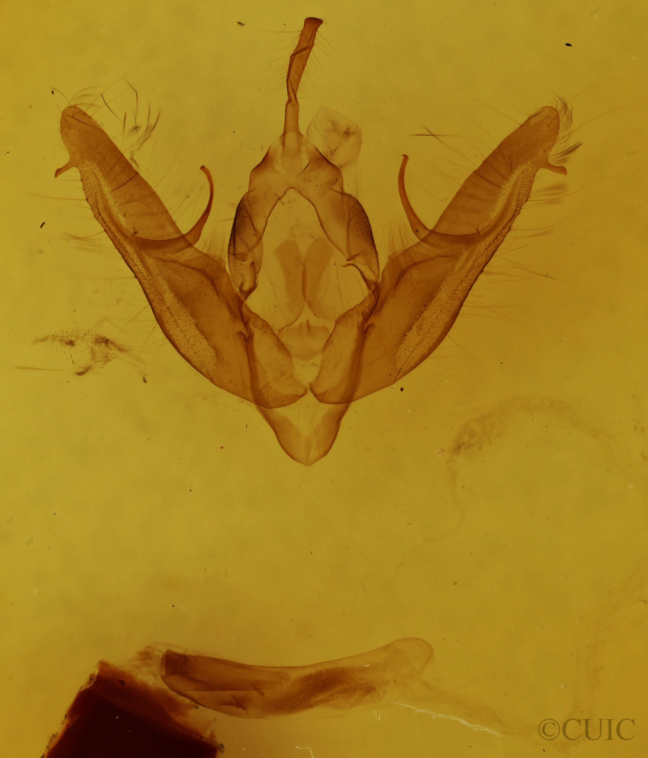 genitalia view of adult Xestia dilucida