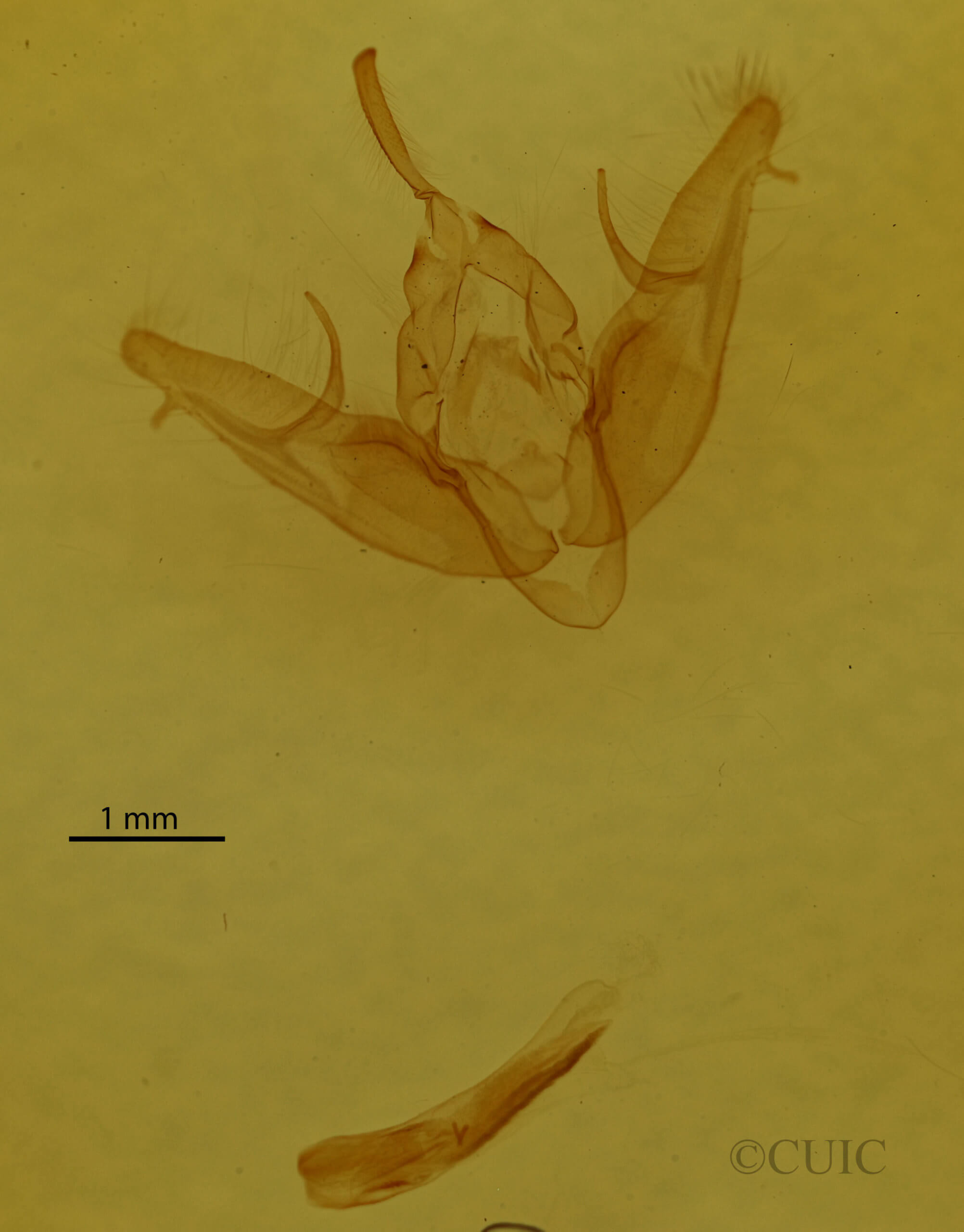 genitalia view of adult Xestia dilucida