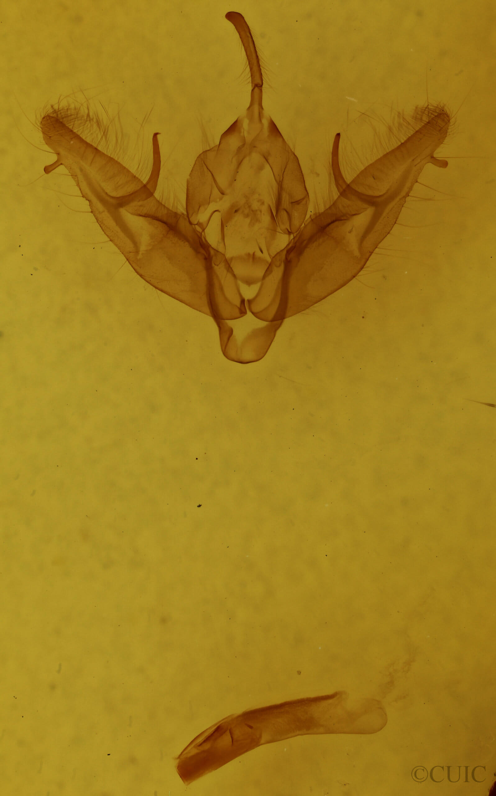 genitalia view of adult Xestia dilucida