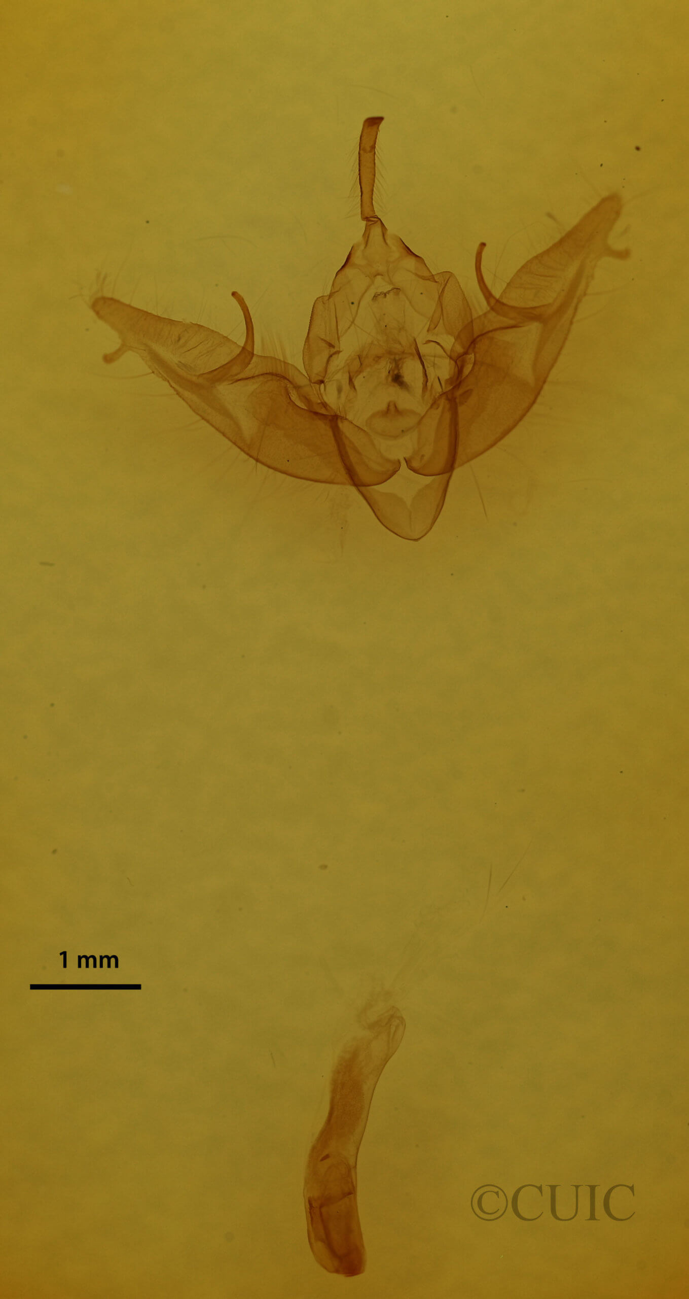 genitalia view of adult Xestia dilucida