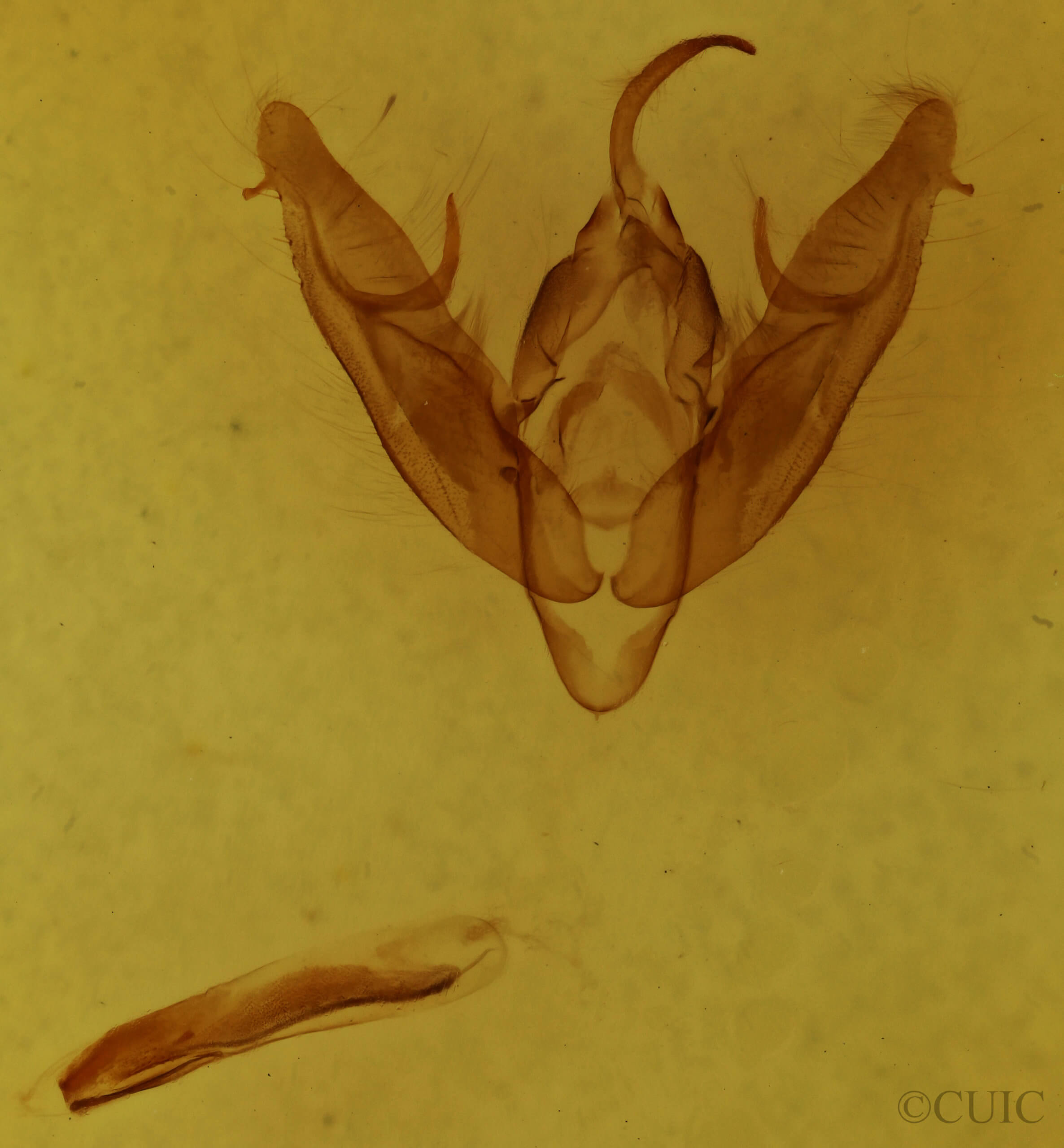 genitalia view of adult Xestia dilucida