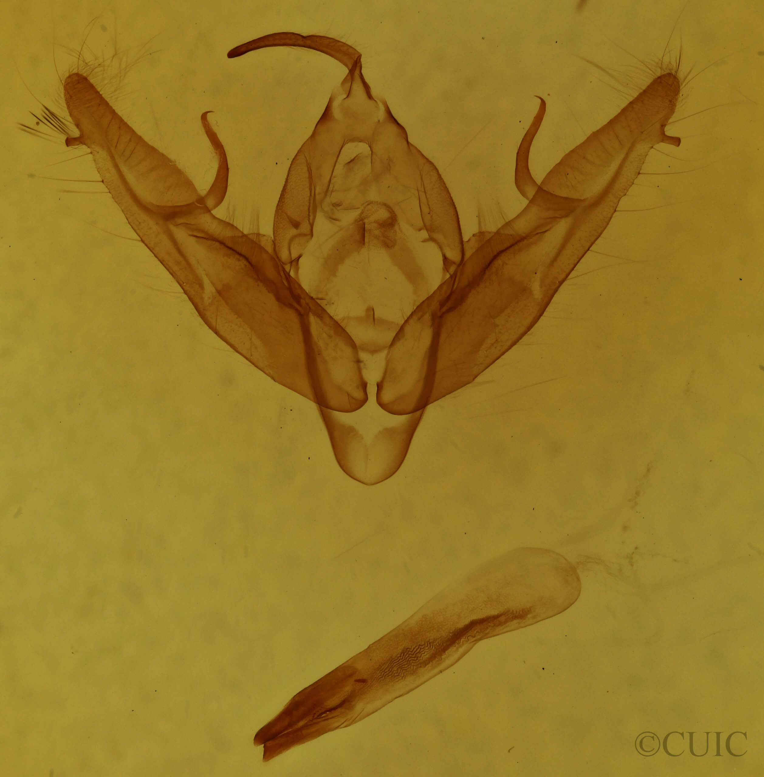 genitalia view of adult Xestia dilucida