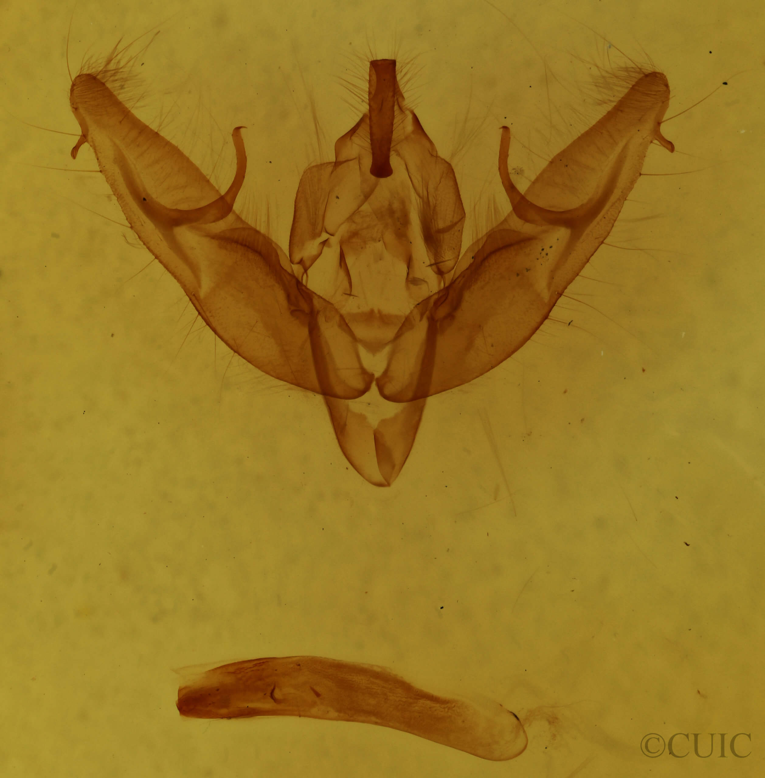 genitalia view of adult Xestia dilucida
