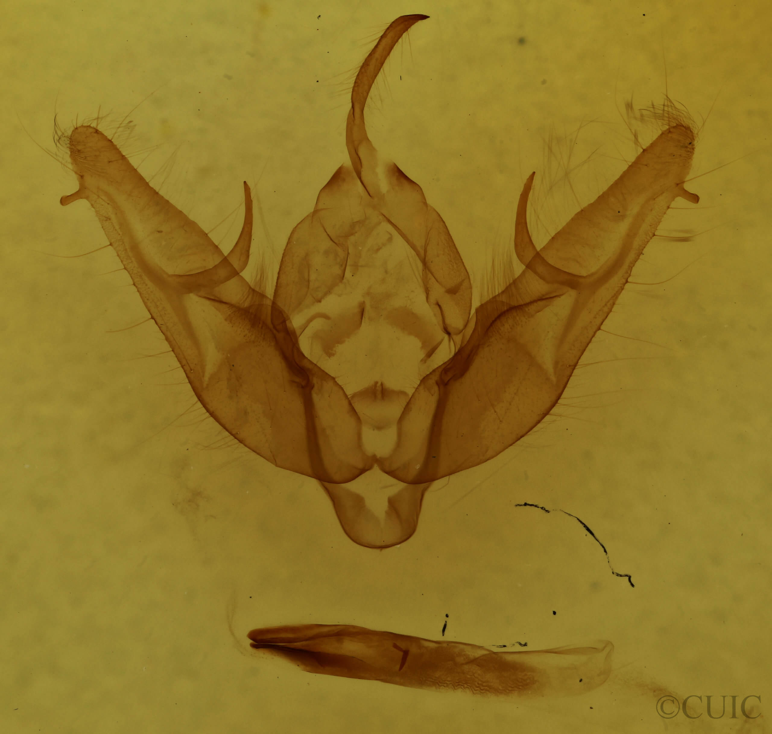 genitalia view of adult Xestia dilucida