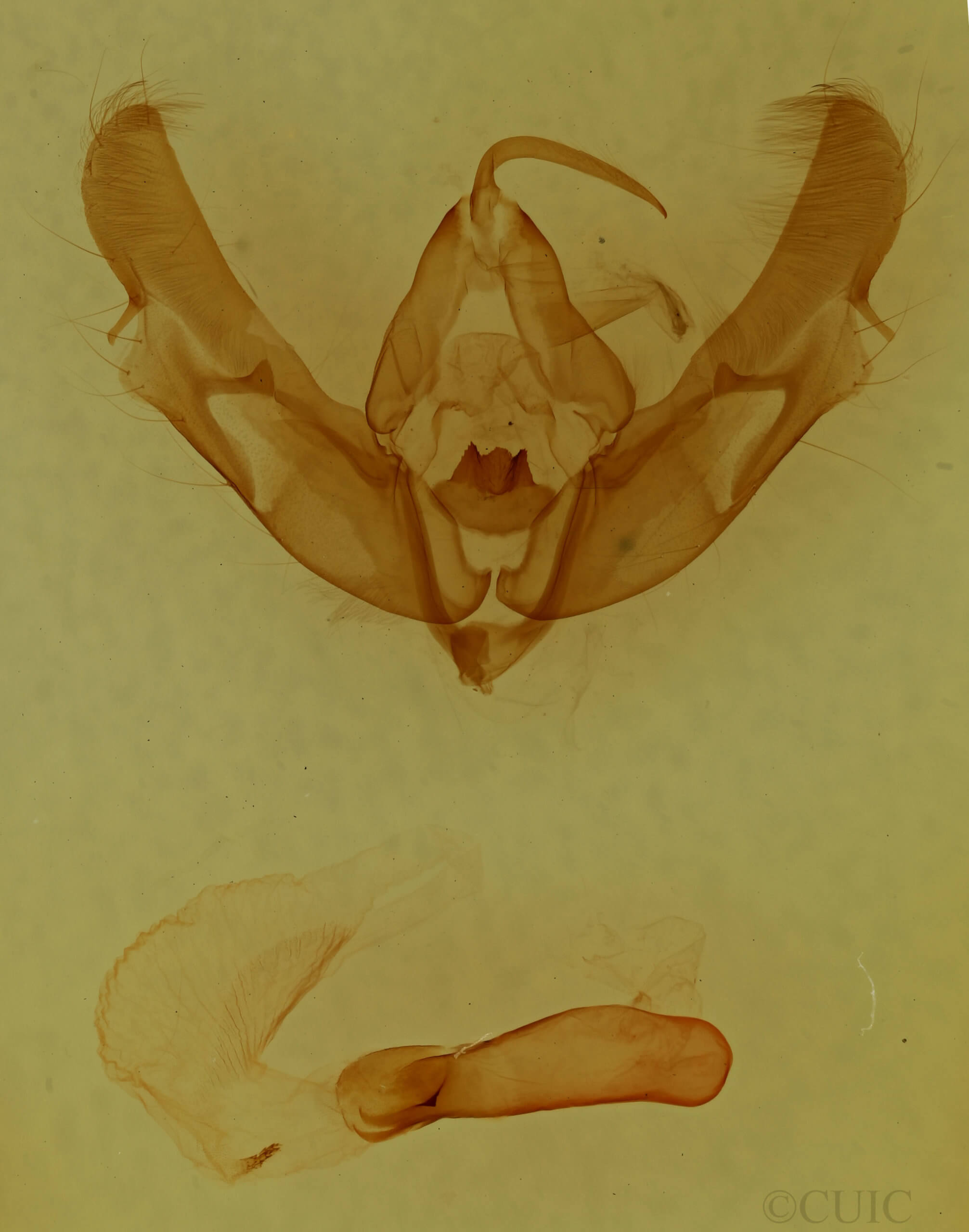 genitalia view of adult Xestia normanianus