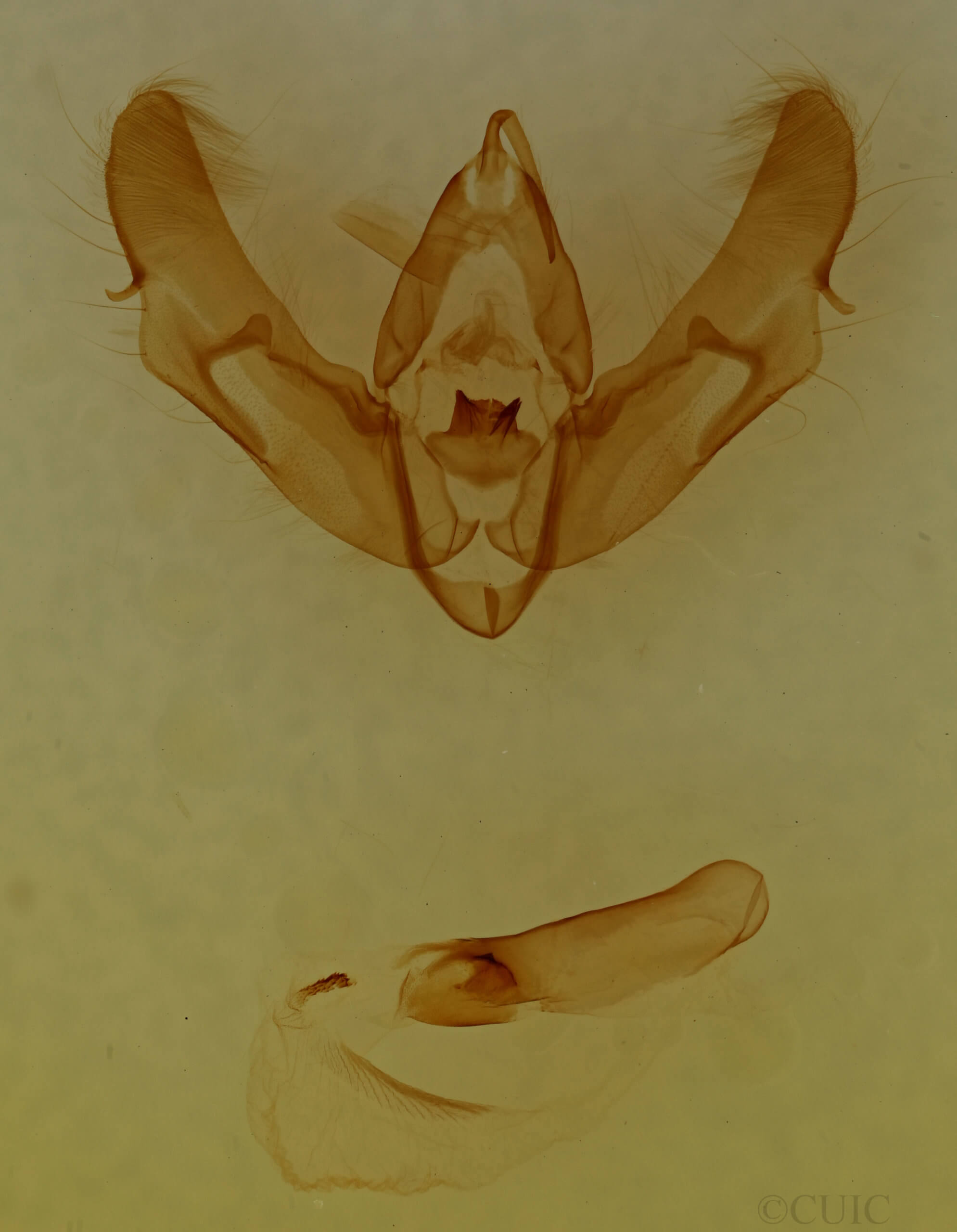 genitalia view of adult Xestia normanianus