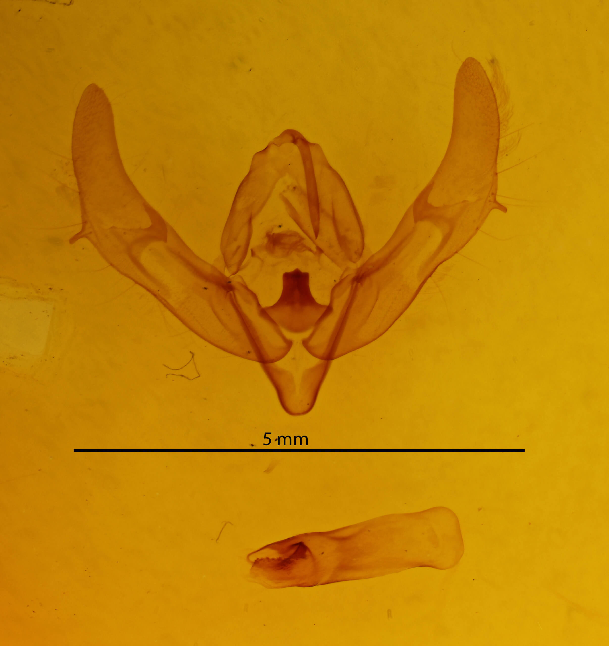 genitalia view of adult Xestia xanthographa