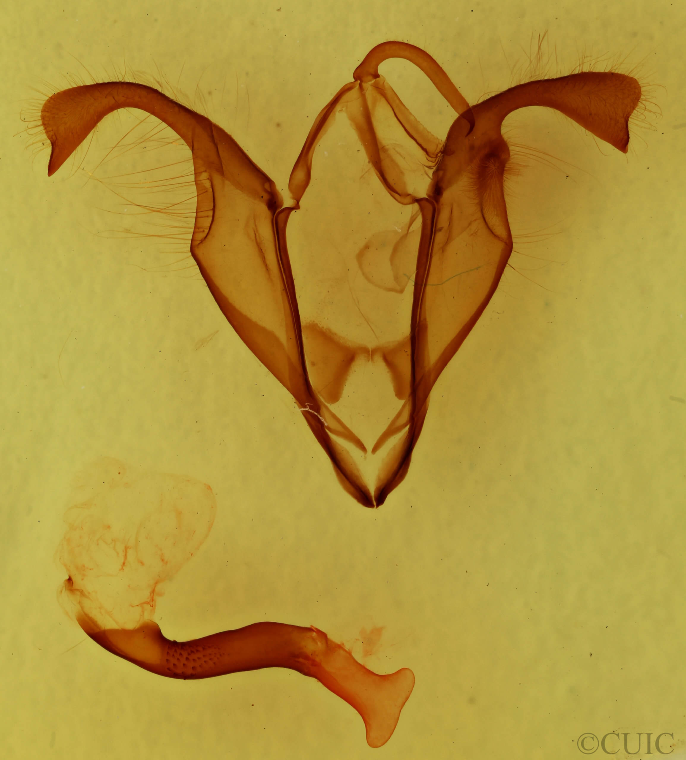 genitalia view of adult Zale calycanthata