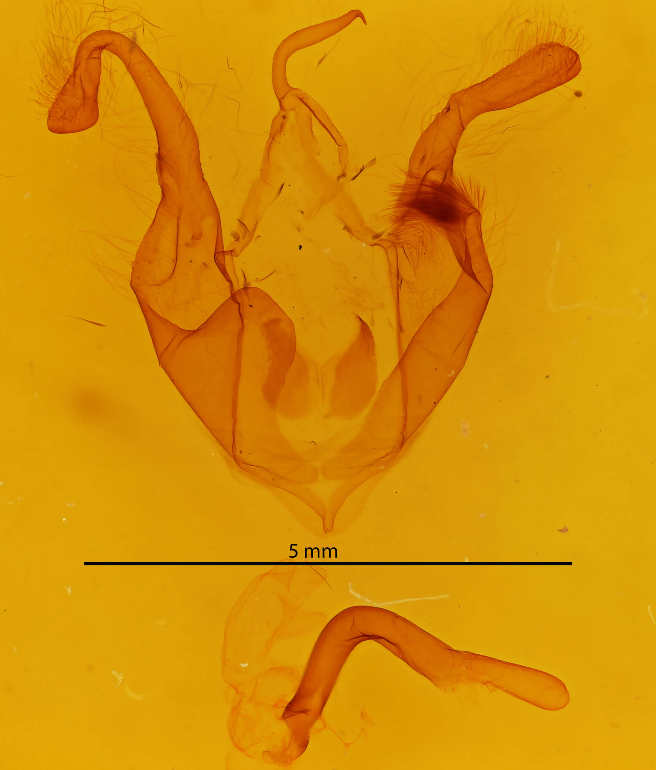 genitalia view of adult Zale undularis
