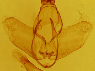 genitalia view of adult Zanola impedita