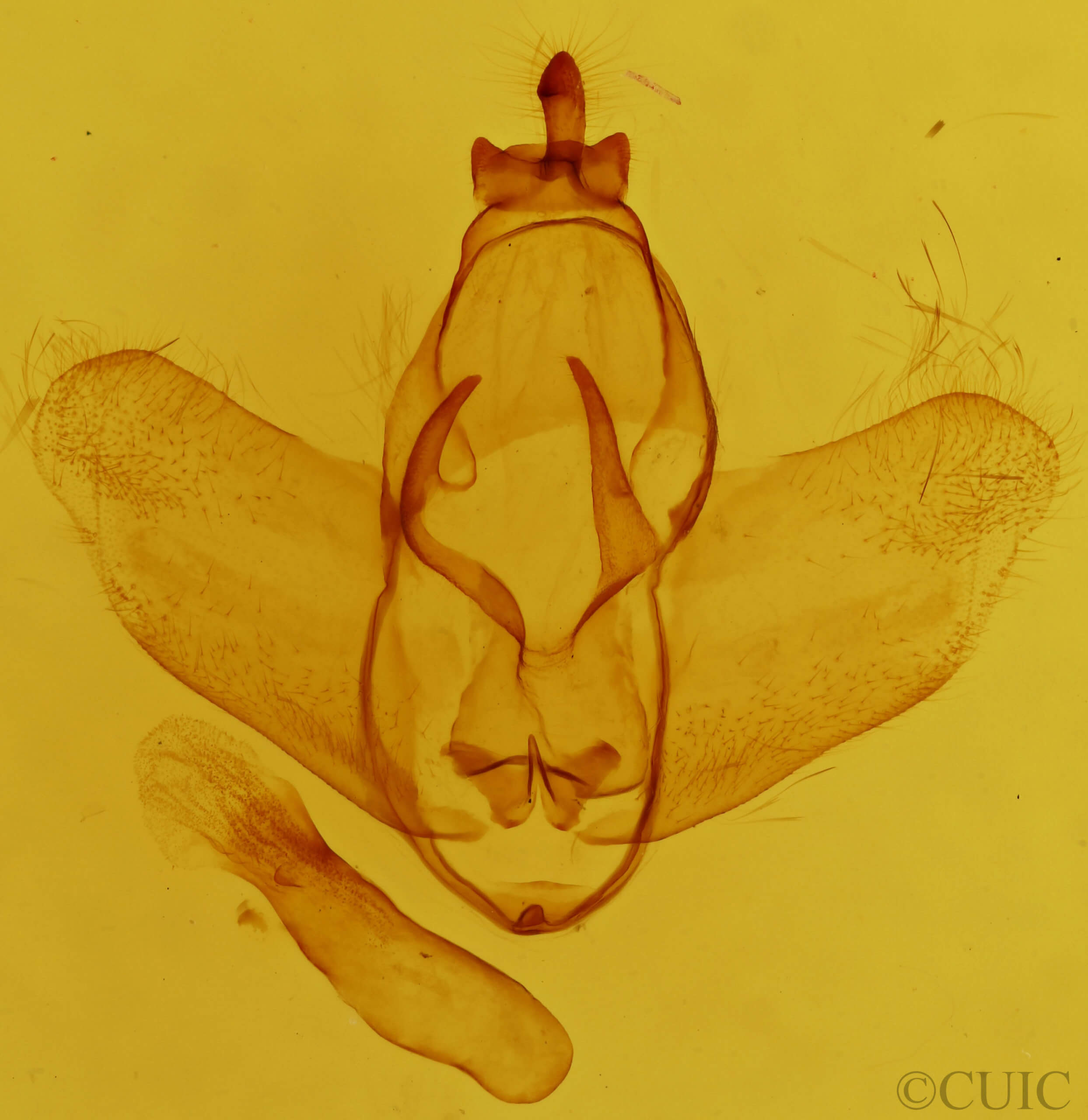genitalia view of adult Zanola impedita