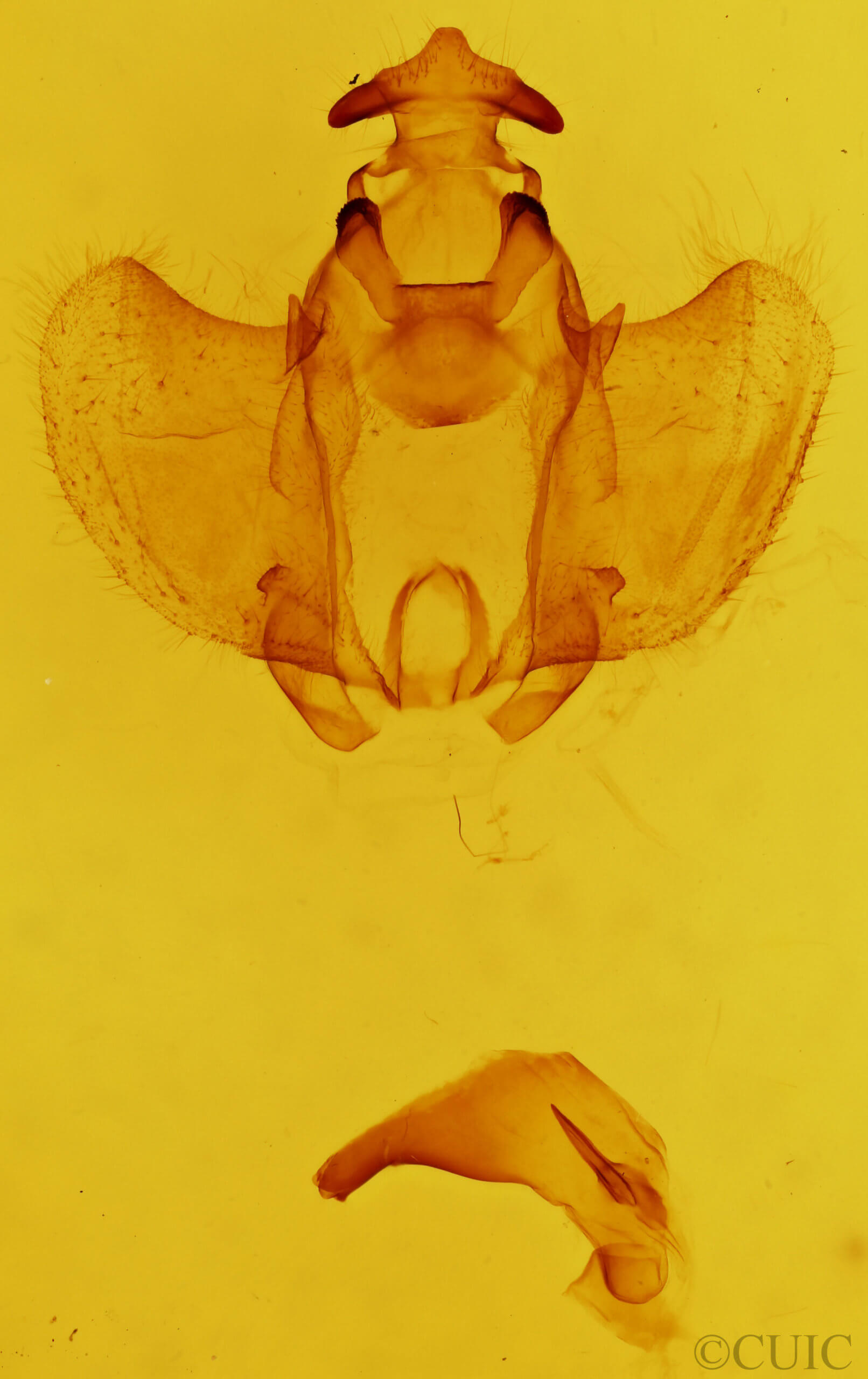 genitalia view of adult Zanola verago