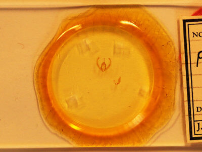 slide view of adult Condica videns