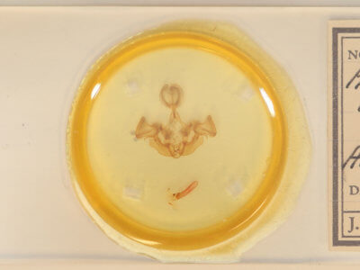 slide view of adult Apamea vulgaris