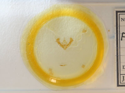 slide view of adult Pseudorthodes