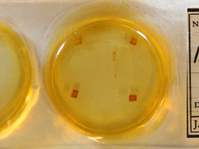 slide view of adult Nigetia formosalis