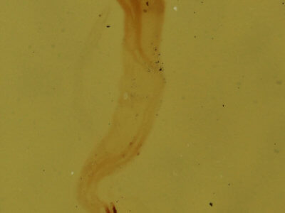genitalia view of adult Nola triquetrana