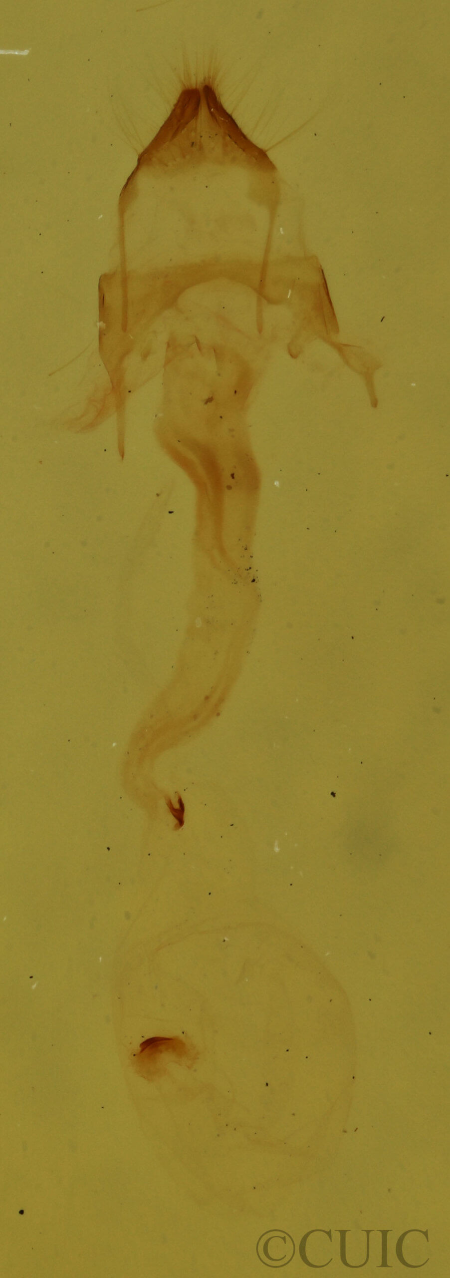 genitalia view of adult Nola triquetrana