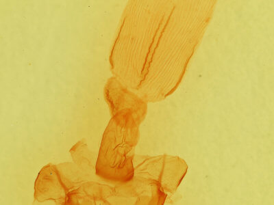 genitalia view of adult Auchmis inextricata