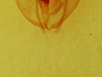 genitalia view of adult Oxydia vesulia
