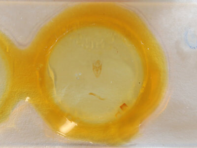 slide view of adult Sosxetra grata