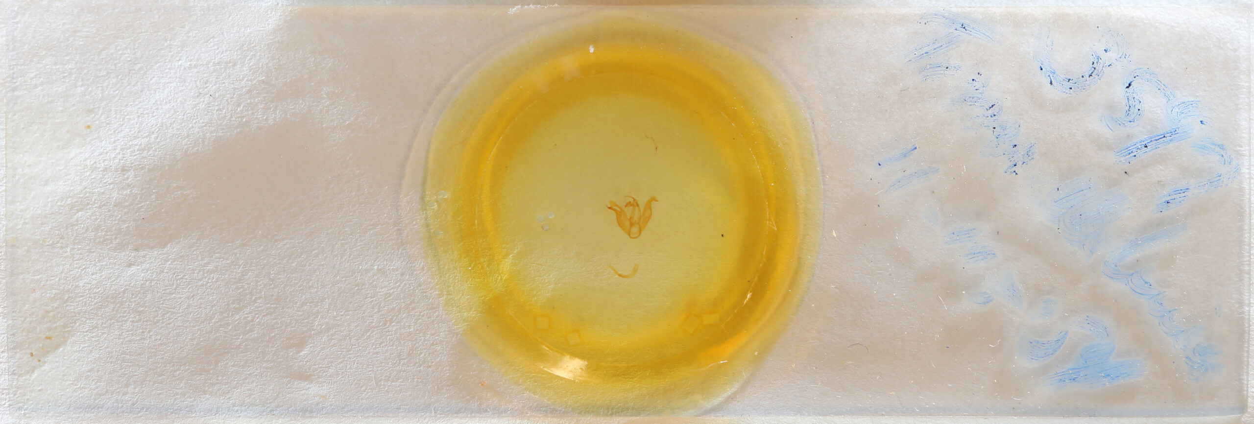 slide view of adult Tyrissa multilinea