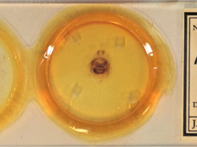 slide view of adult Nerica bidentata