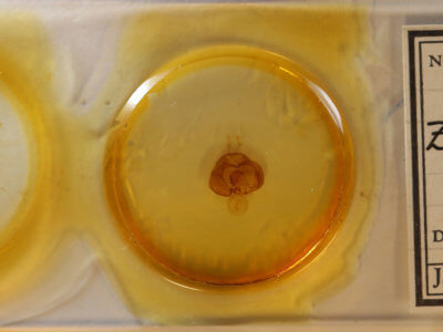 slide view of adult Zale confusa