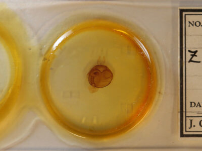 slide view of adult Zale buchholzi