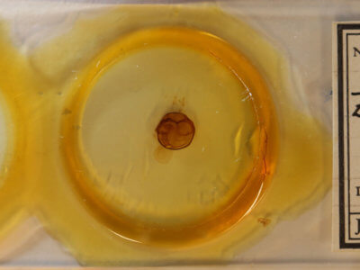 slide view of adult Zale helata