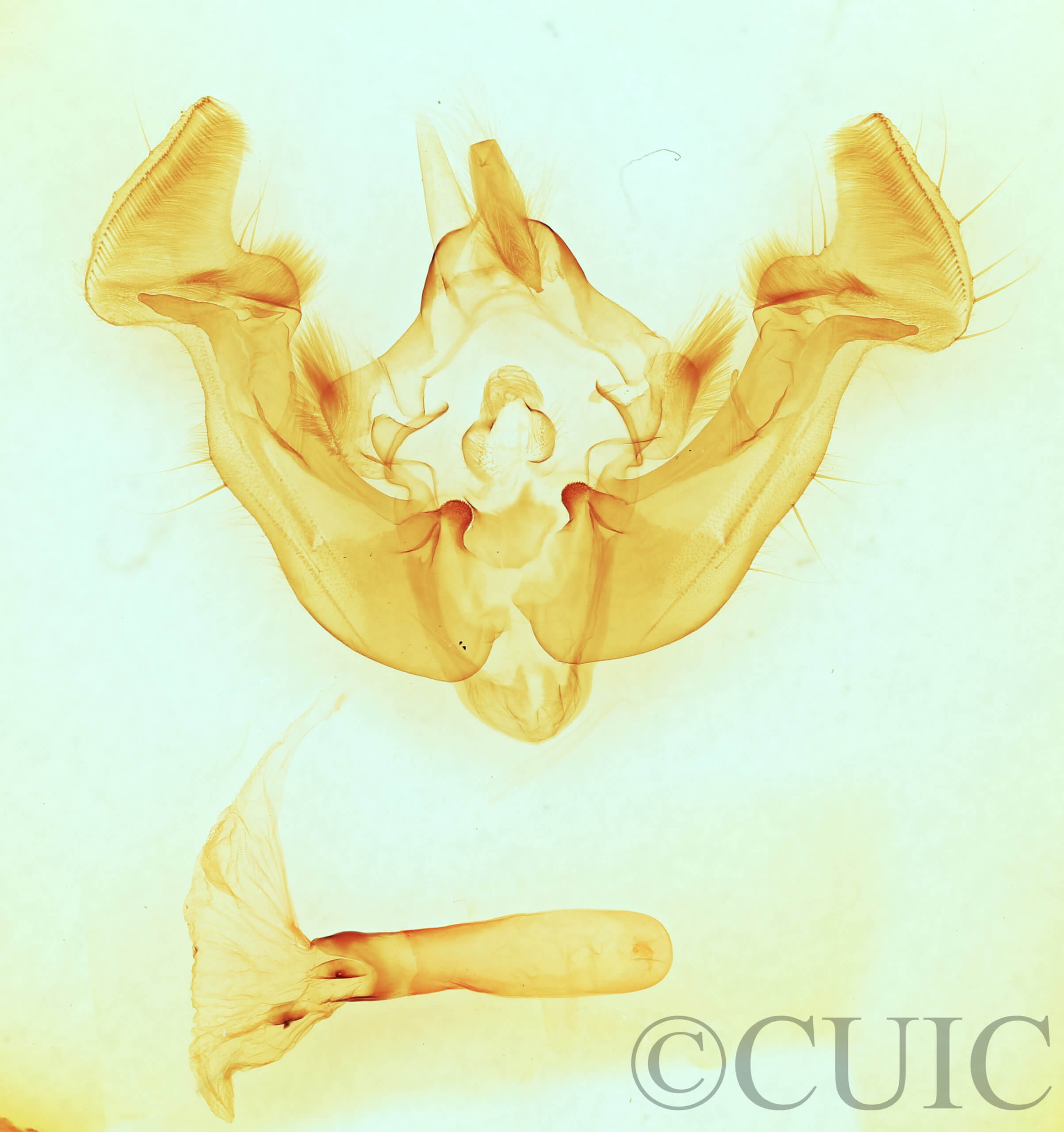 genitalia view of adult Apamea zeta exulis