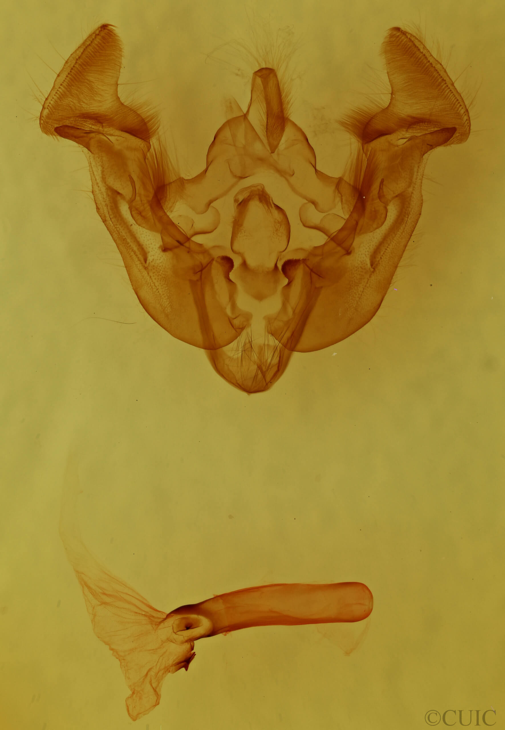 genitalia view of adult Apamea zeta murrayi