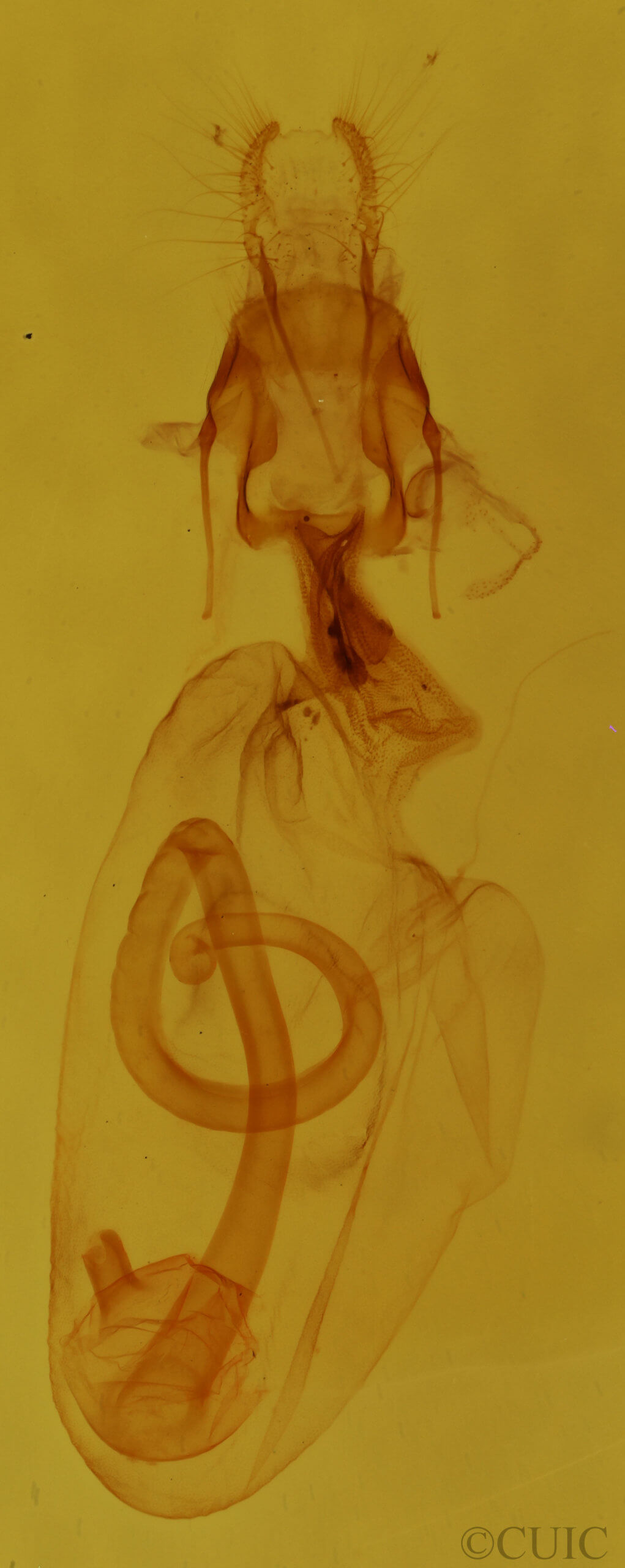 genitalia view of adult Elaphria festivoides