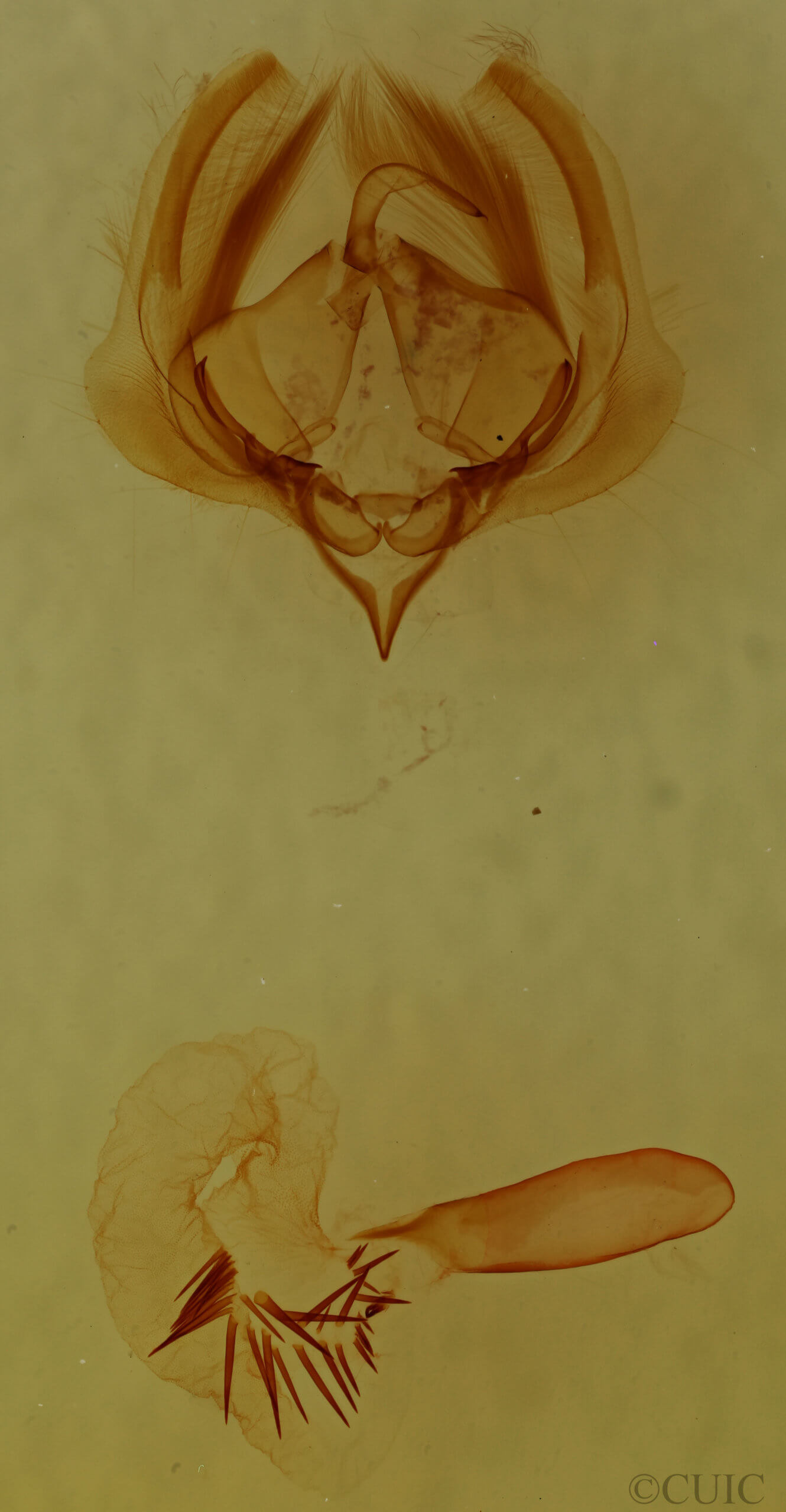 genitalia view of adult Elaphria festivoides
