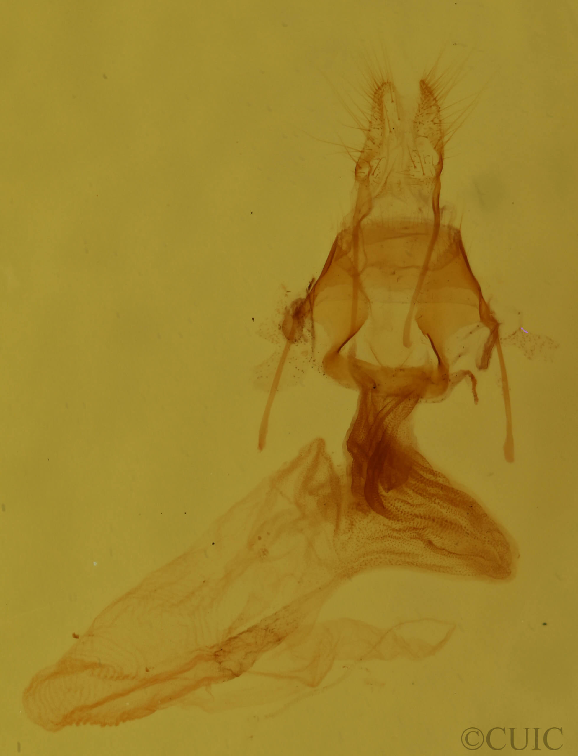 genitalia view of adult Elaphria festivoides