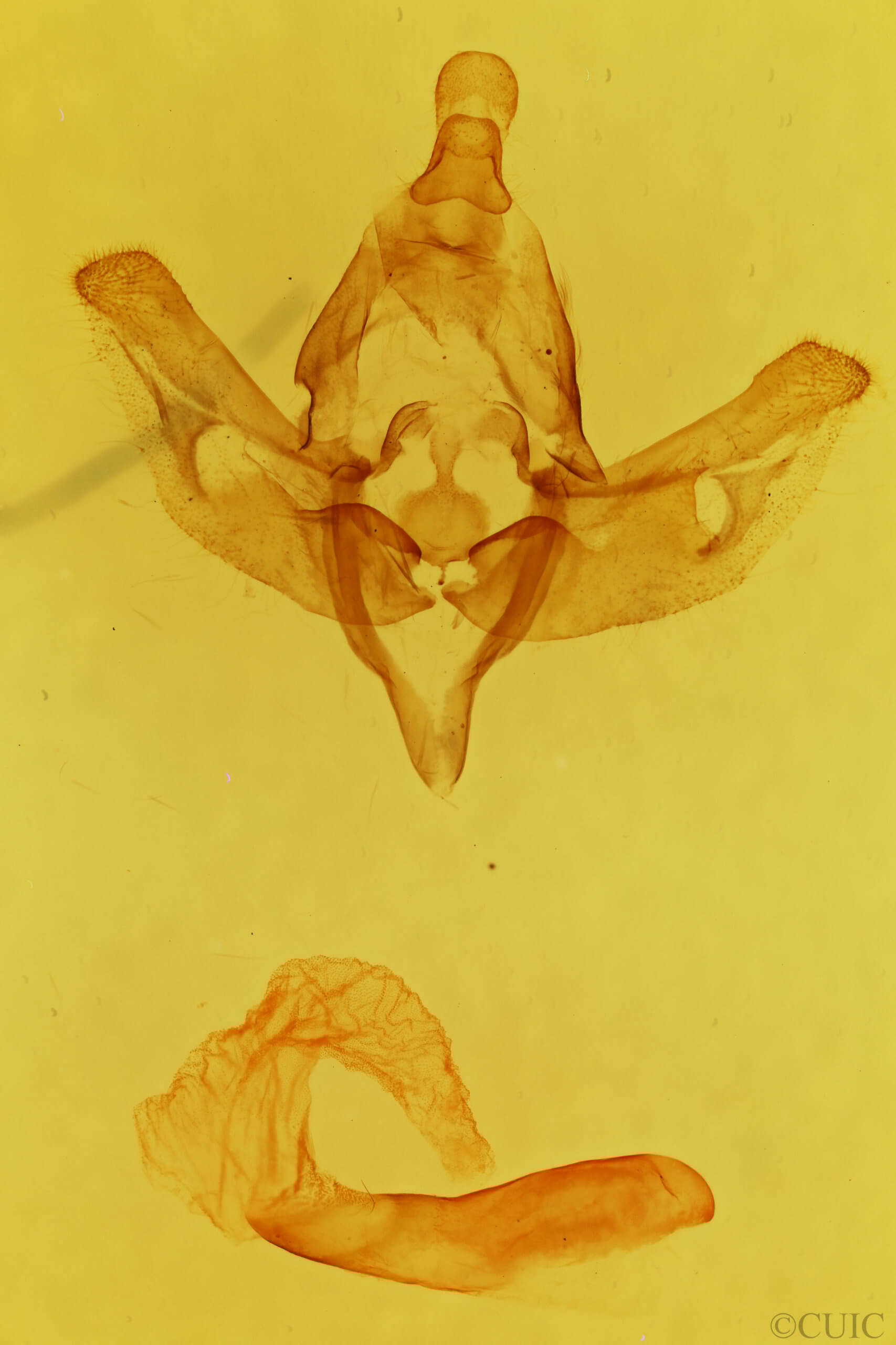 genitalia view of adult Xanthopastis regnatrix