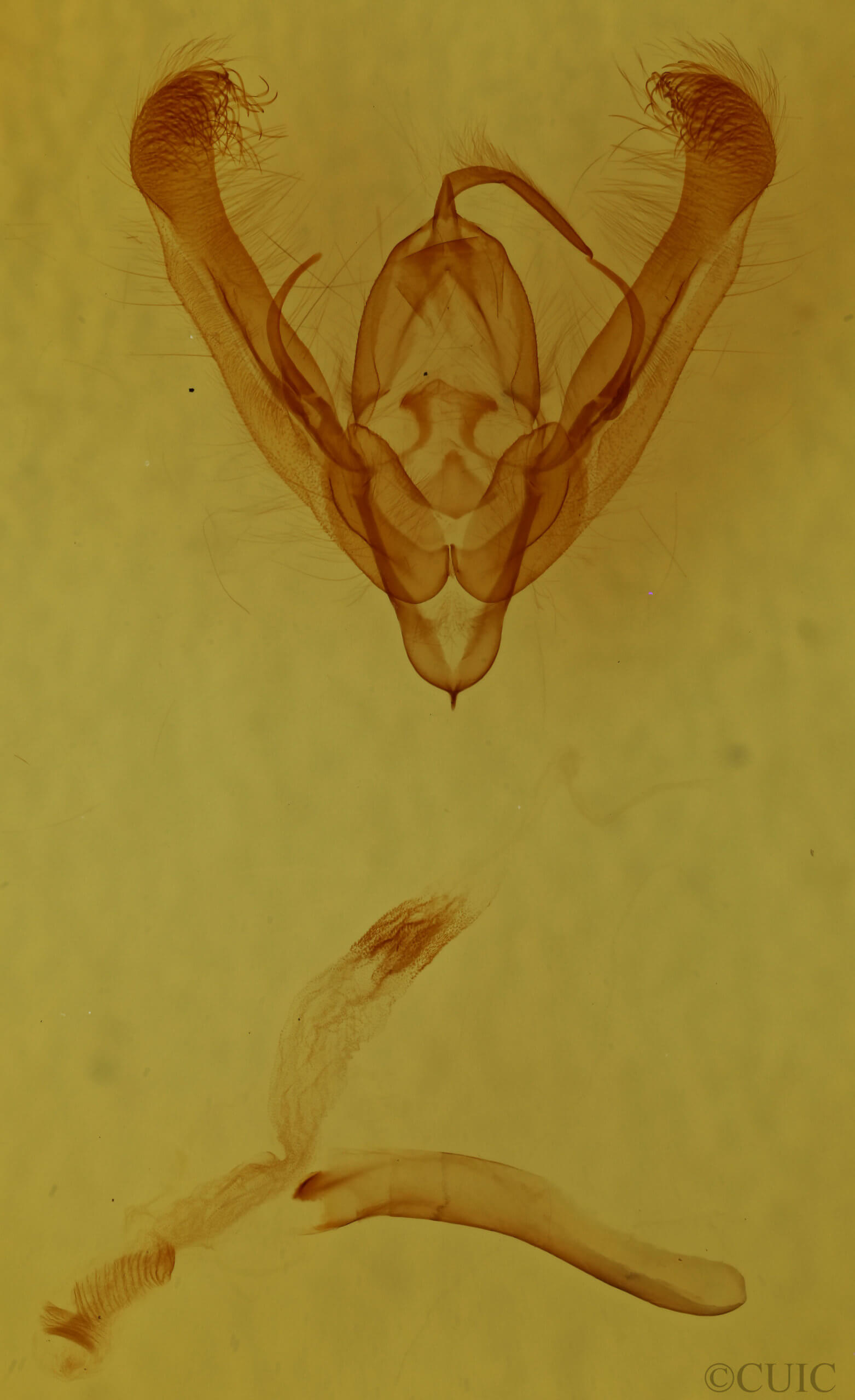 genitalia view of adult Ulolonche modesta