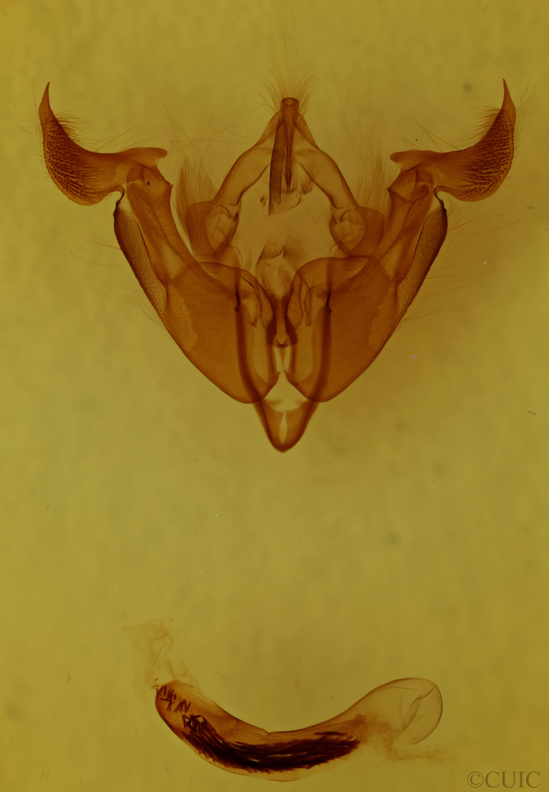 genitalia view of adult Trichordestra rugosa