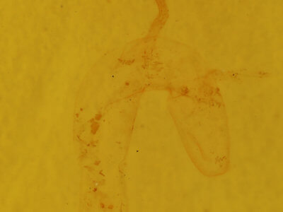 genitalia view of adult Feltia subterranea