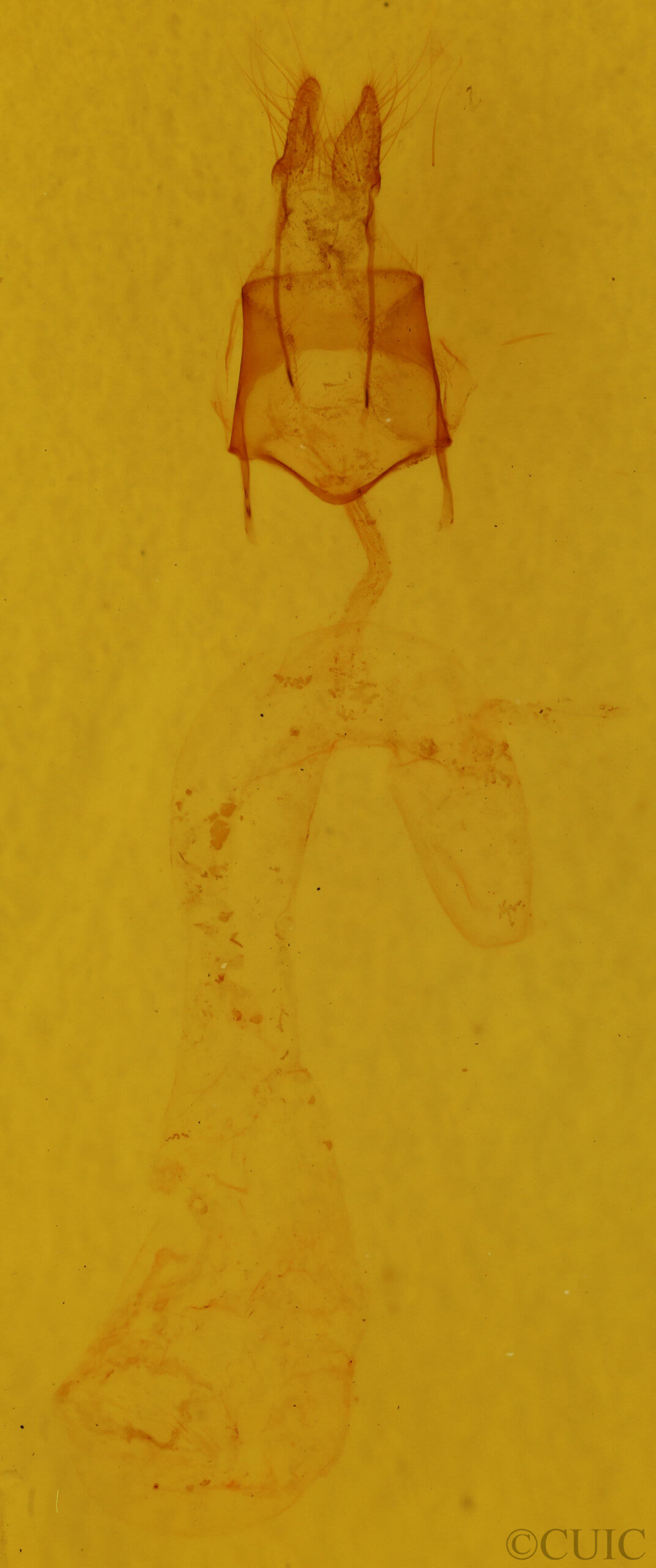 genitalia view of adult Feltia subterranea