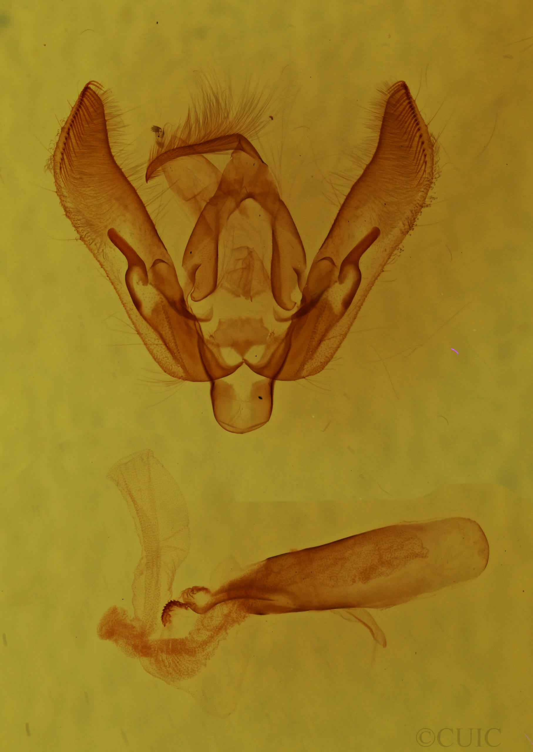 genitalia view of adult Agrotis vetusta
