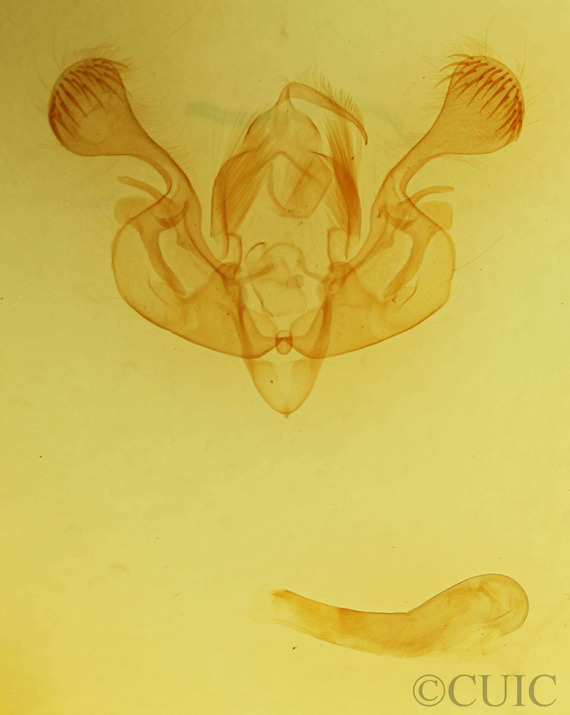 genitalia view of adult Mythimna albipuncta