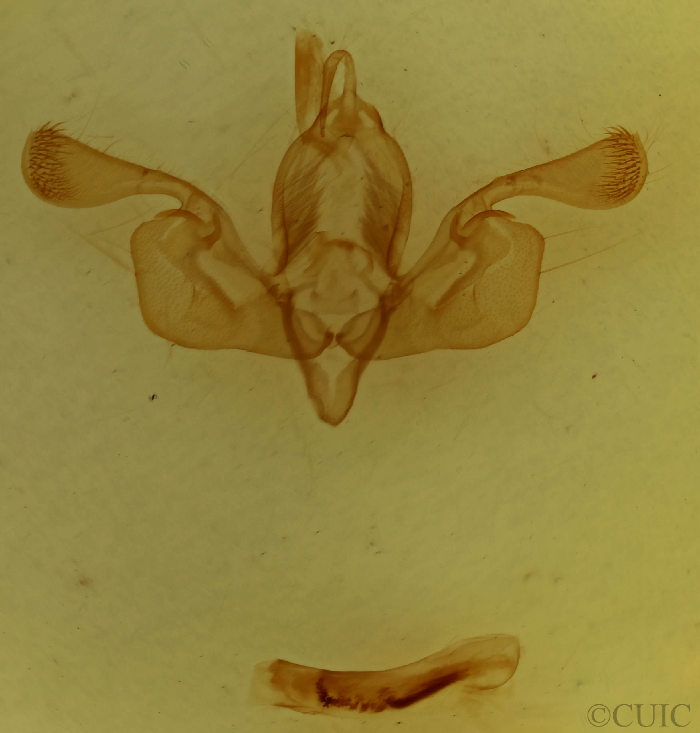 genitalia view of adult Mythimna impura